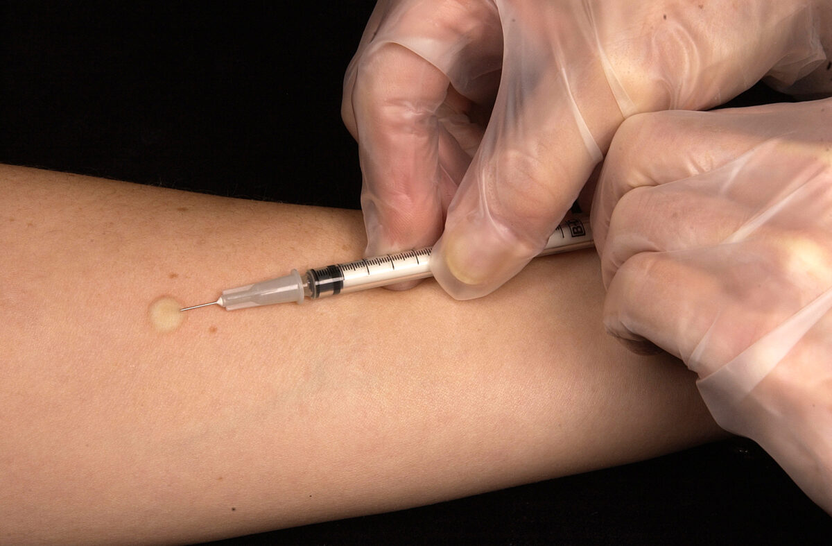 How-Often-Do-You-Need-a-TB-Test-in-Healthcare-1200x787.jpg